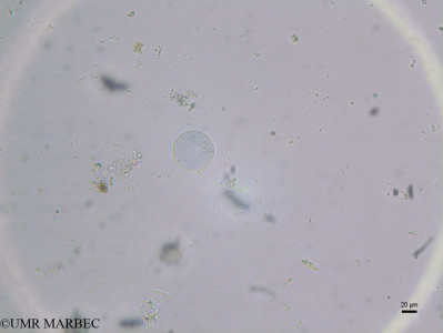 phyto/Brazilian_Nordeste/FernandodeNoronha_station40/ABRACOS2 April 2017/Spatangidium arachne (st41_INF_Diatomee32_centrique170915_002_ovl)(copy)_thumb.jpg